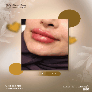 دكتور سحر حالة 6 1